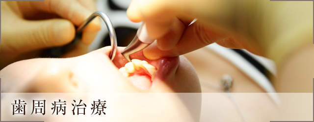 本郷三丁目で歯周病治療なら、本郷四丁目歯科へ